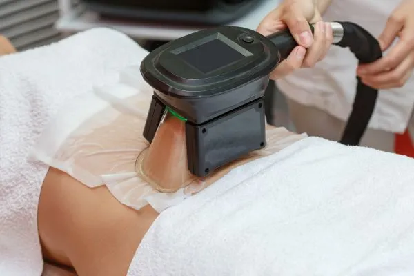 Image of person having fat freezing treatment to help weight gain Warwickshire