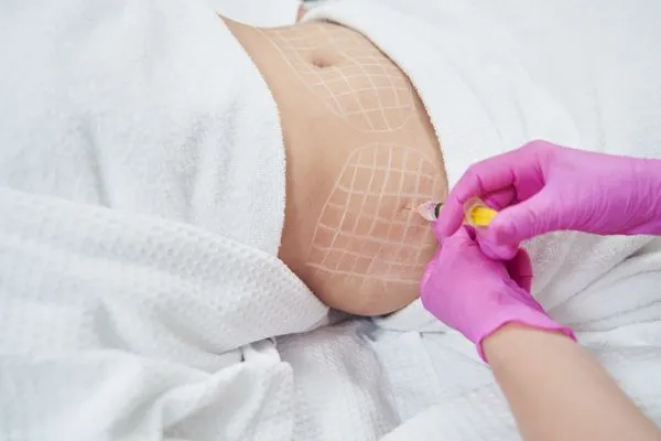 image of fat dissolving injections on love handles to help combat weight gain Warwickshire