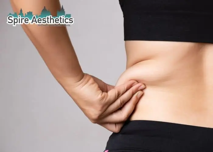 Image of woman pinching fat on their hips Warwickshire. Fat Freezing treatment