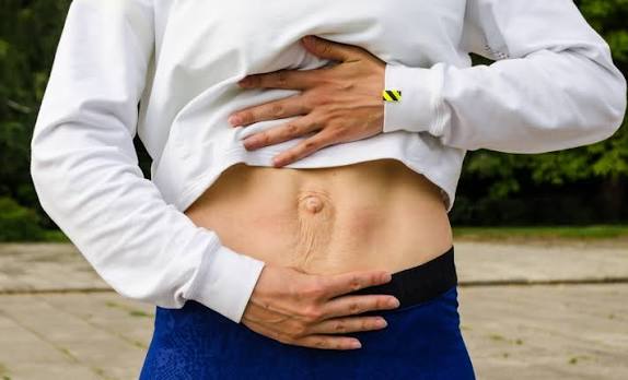When Could Diastasis Recti Be the Missing Piece of the Puzzle Warwickshire?